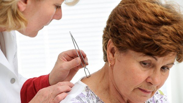 ТОП 6 методів як витягнути кліща 3 Як витягнути кліща