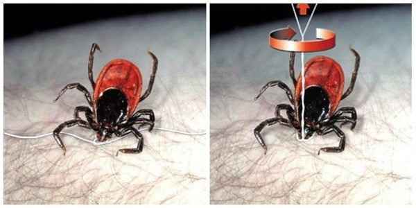 ТОП 6 методів як витягнути кліща 5 Як витягнути кліща