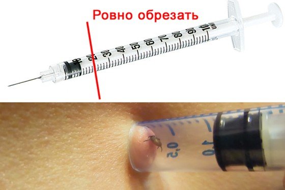 ТОП 6 методів як витягнути кліща 7 Як витягнути кліща